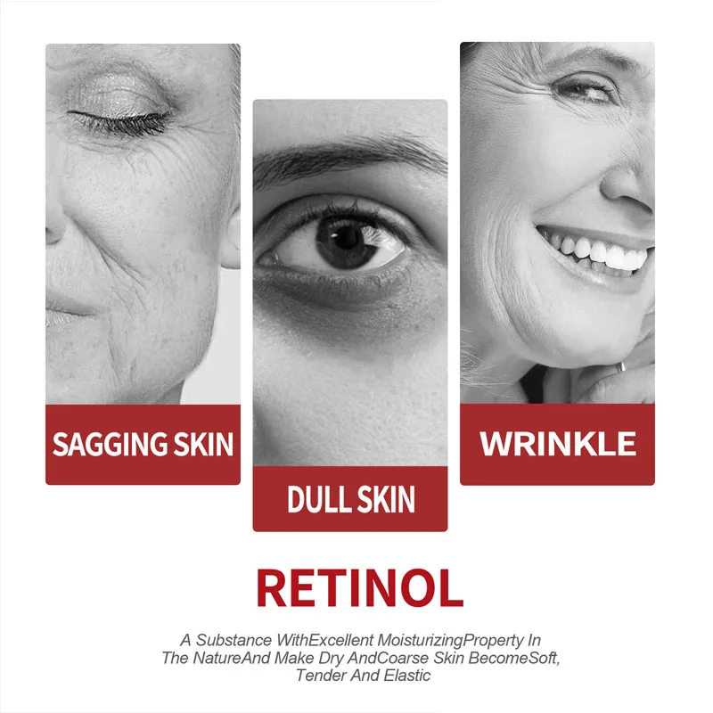 Retinol Cream  Moisturizing Sk - огляд і ціна Milk Thistle Silymarin